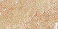 CS1006373